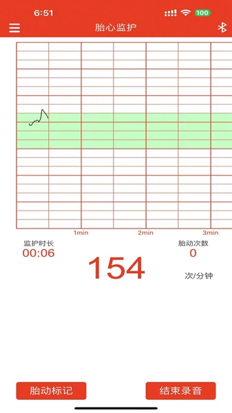 左点胎心仪app手机版